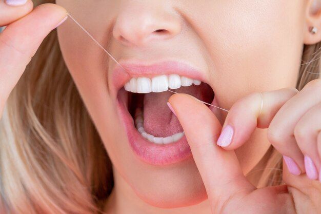 Fio dental pode reduzir o risco de AVC?
