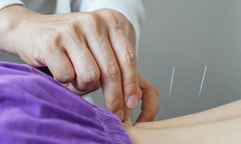 Revolução das Agulhas: Acupuntura agora é profissão no Brasil. O que muda?
