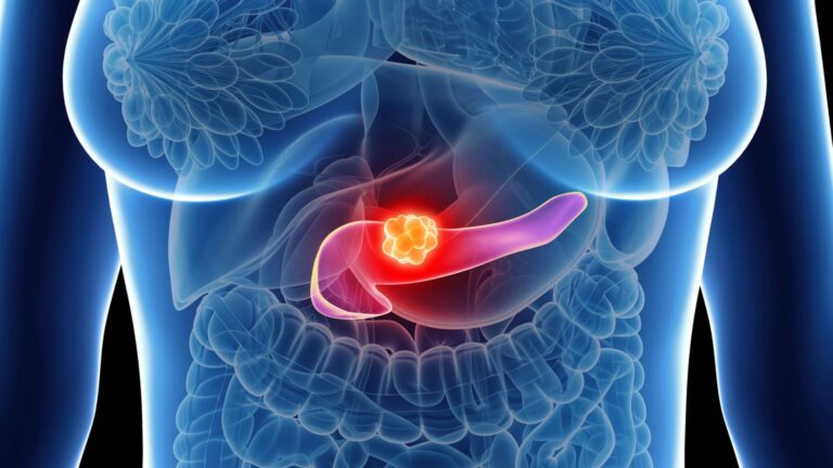 Como um dos cânceres mais letais do mundo foi eliminado? A descoberta que mudará tudo…