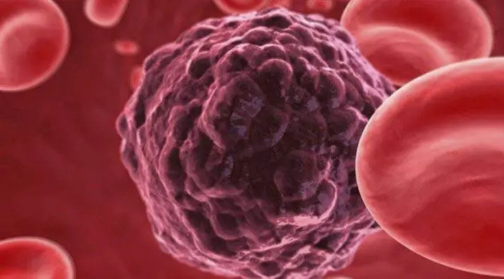 Cientistas do Canadá criam bactéria que “come” câncer de dentro pra fora