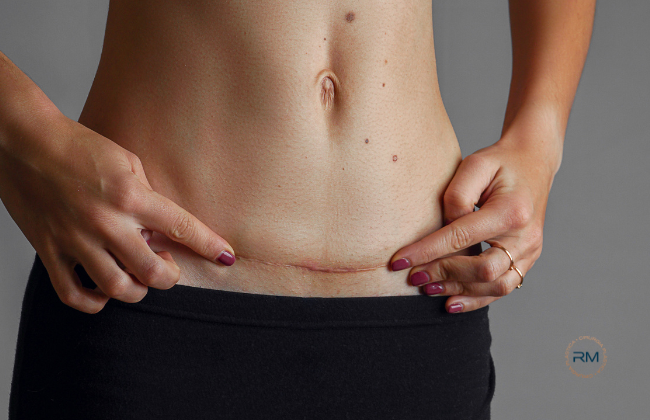 Cientistas brasileiros criam pomada que cicatriza feridas sem deixar marcas