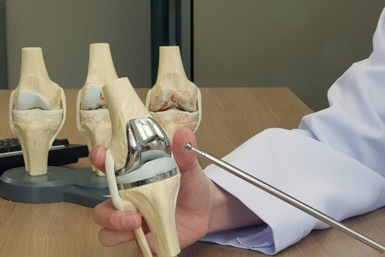 Qual o melhor caminho: prótese de joelho ou regeneração biológica?