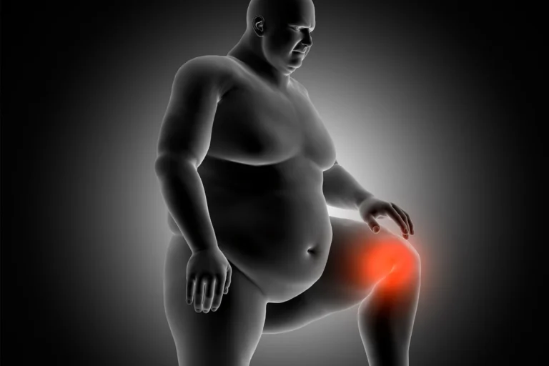 A cada 1 kg que você perde a pressão no seu joelho reduz em 4 kg