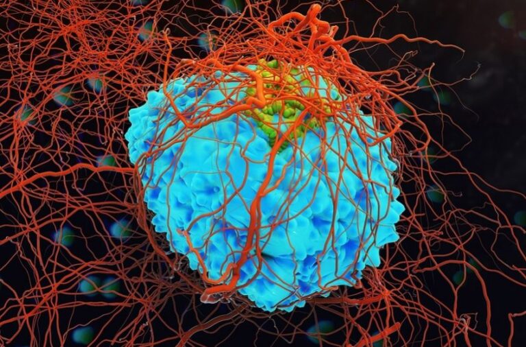 Cientistas descobrem molécula que mata o câncer de fome