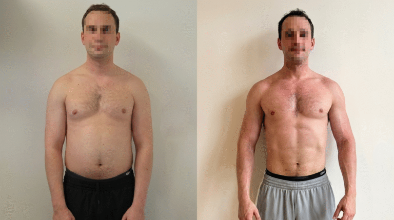 Nutricionistas agora são proibidos de postar antes e depois nas redes sociais