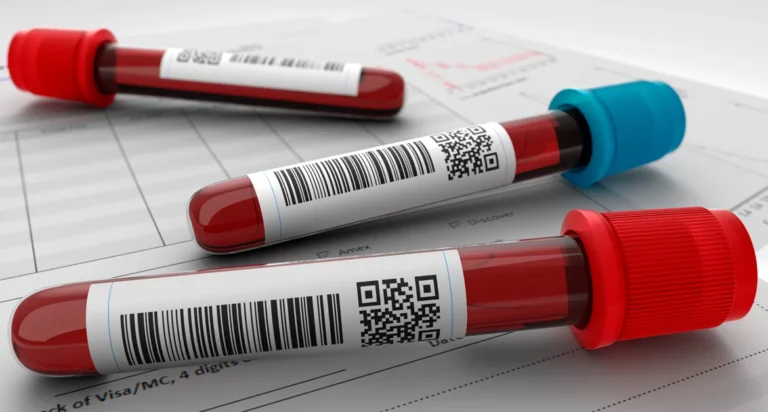Novo exame de sangue detecta câncer de intestino antes dos sintomas aparecerem