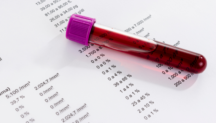 Estudo investiga se existe riscos de transmissão do Alzheimer pelo sangue