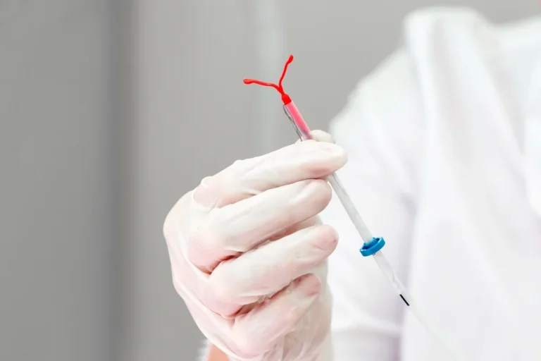 Planos de saúde vão começar a cobrir DIU hormonal para mulheres com endometriose